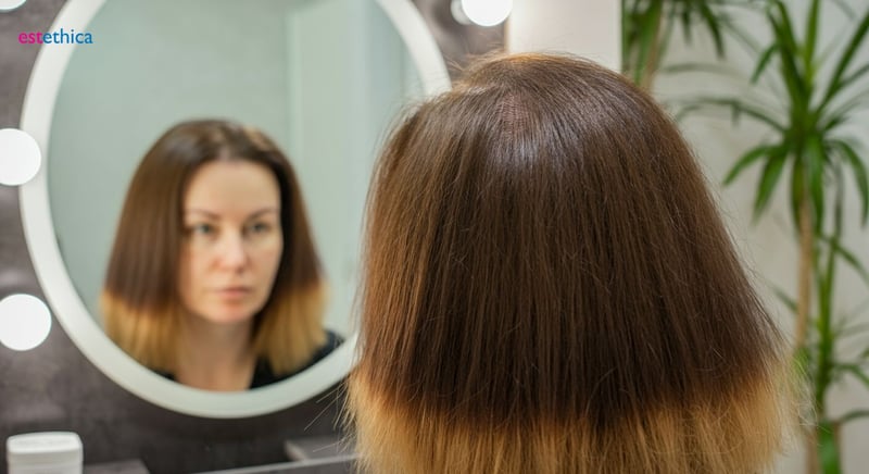 اختيار عيادة زراعة الشعر الأفضل لنتائج مضمونة