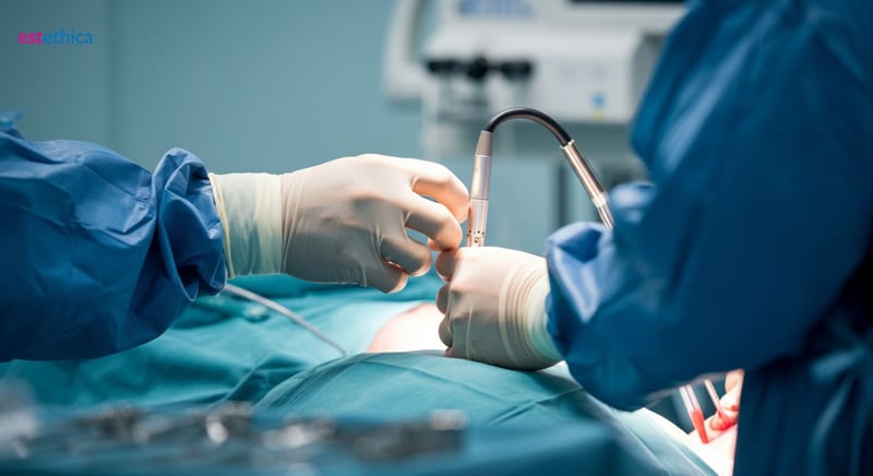 رأب المهبل: دليل شامل للإجراءات والنتائج المتوقعة