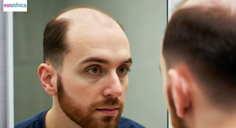 مخاطر زراعة الشعر وكيفية تجنبها