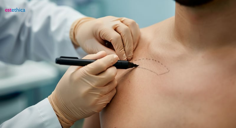 Хирургия на гинекомастия: подходящо време и очаквания