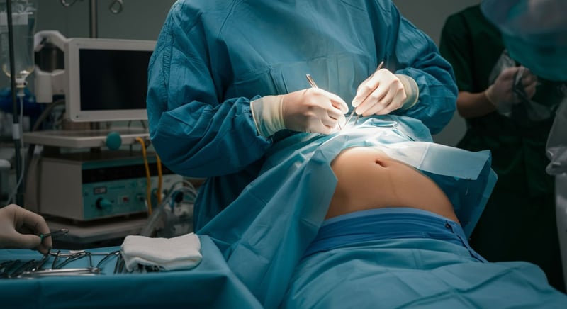 Préparation pour une abdominoplastie réussie