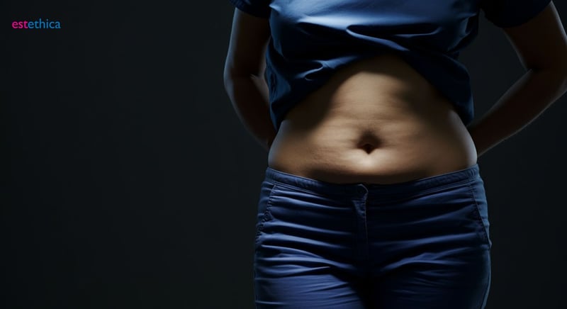 Abdominoplasty techniques: Choosing your ideal approach