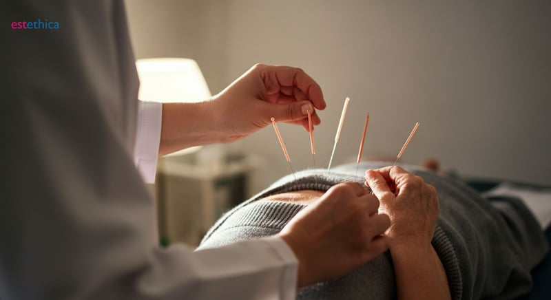 Acupunctura pentru Dureri de Spate: Soluția Naturală