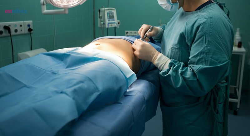 Липосукция процедура безопасност