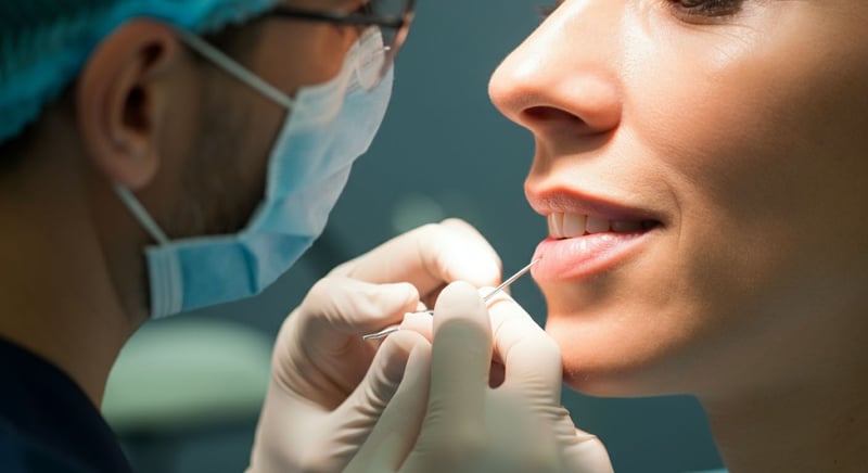 Augmentation lèvre supérieure : techniques et résultats naturels