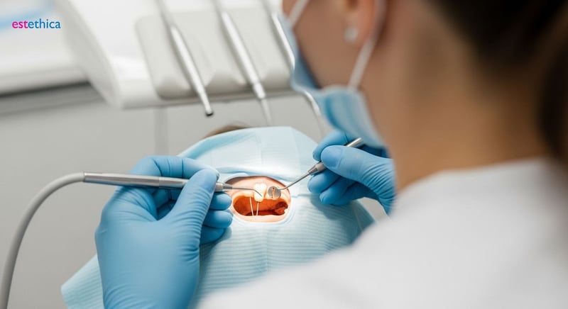 Avantajele plombelor dentare pentru sănătatea orală