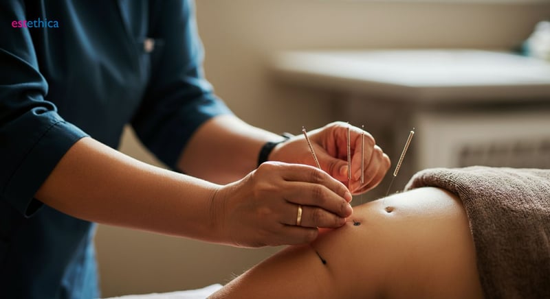 Beneficios ocultos de la acupuntura para la salud integral