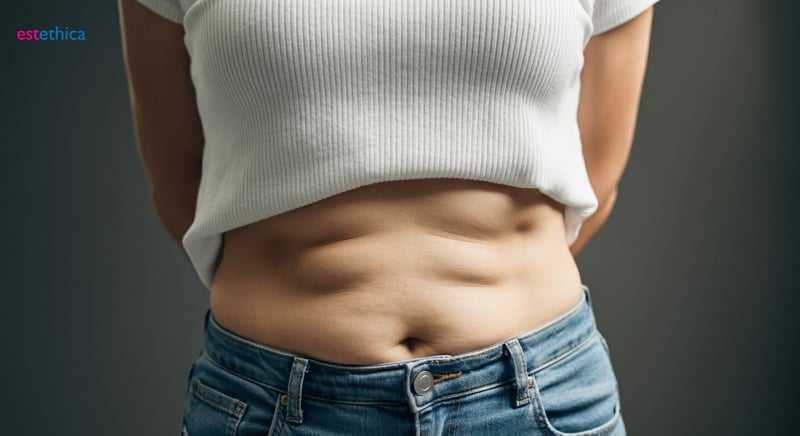 Tummy tuck muscle repair benefits