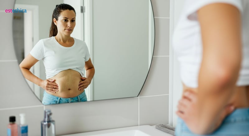 Tummy tuck recovery tips for optimal results