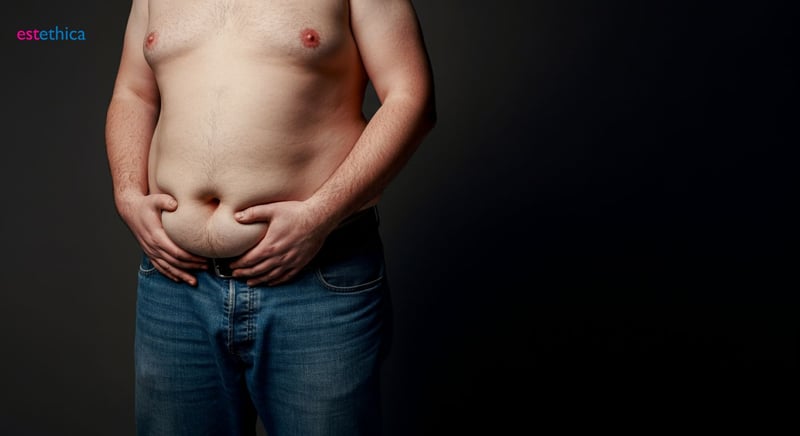 Post-weight loss surgery recovery expectations