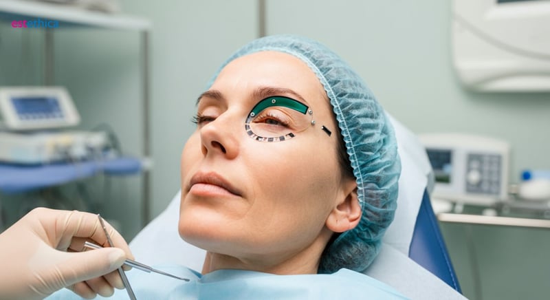 Blefaroplastia antes y después: Consejos de recuperación