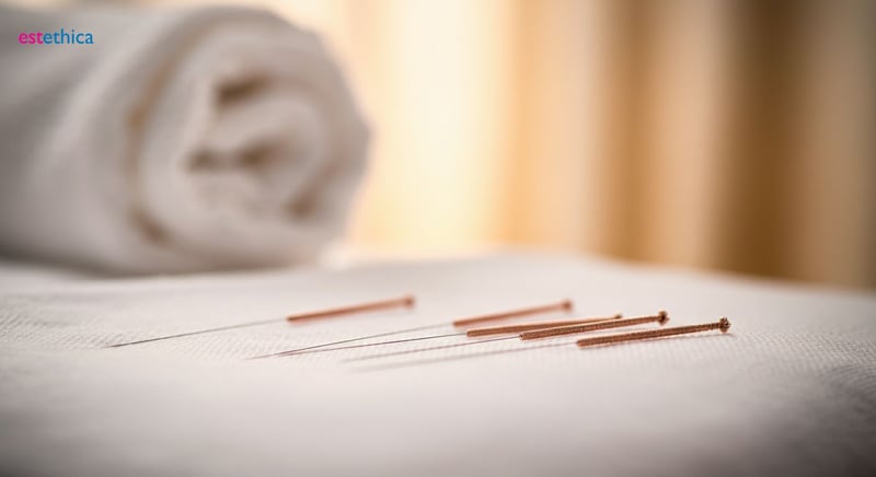 Beneficios de la Medicina Tradicional China para la salud