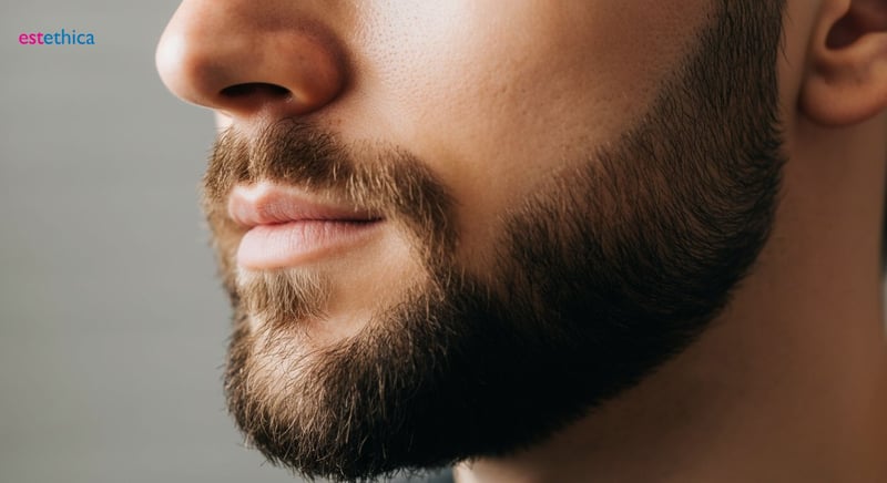 Candidato ideal para implante de barba