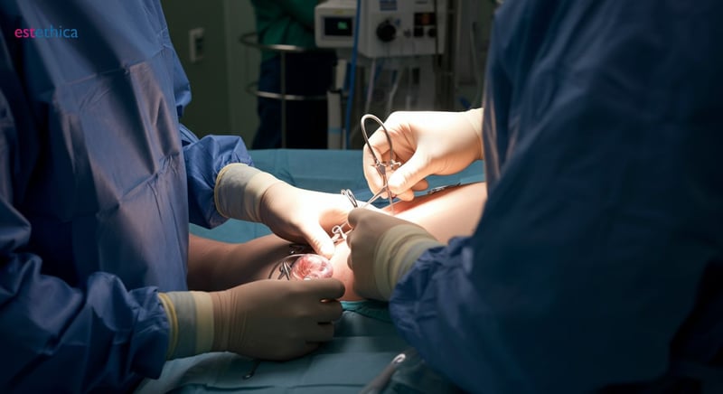 فوائد تكميم المعدة لصحتك العامة
