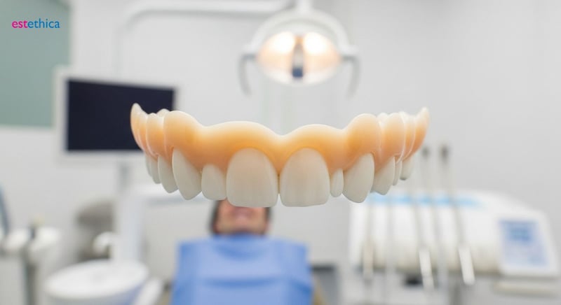 Carillas dentales para una sonrisa perfecta