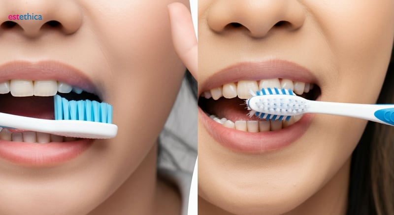 Cauzele ascunse ale retracției gingivale: factori de risc și prevenție