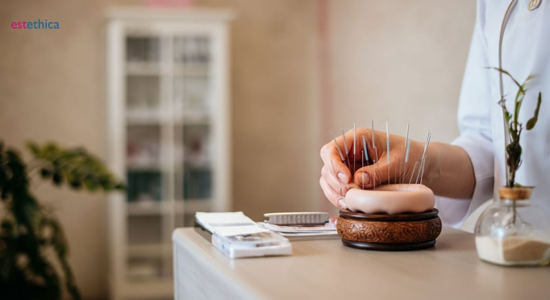 Acupunctura: tehnică tradițională chineză de vindecare
