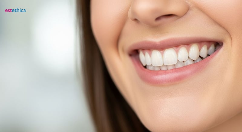 تجميل الأسنان: نصائح للحفاظ على ابتسامة هوليود