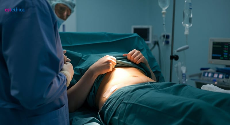 Chirurgia abdomenului: tehnici moderne pentru contur perfect