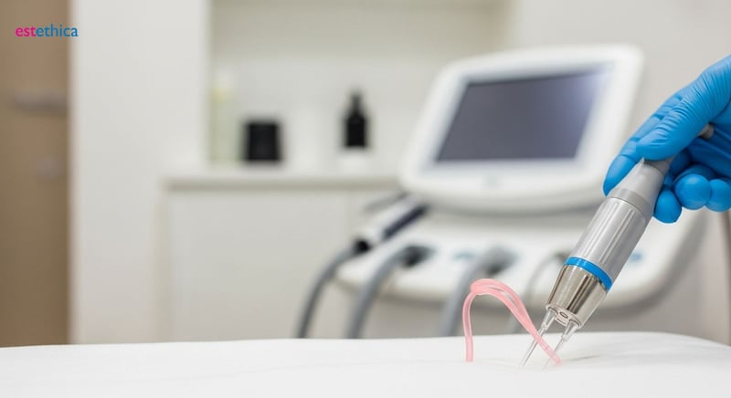 Chirurgie vaginale : options de reconstruction
