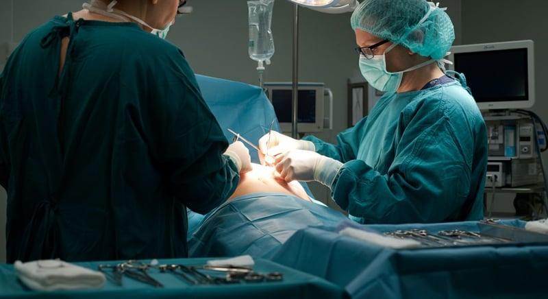 Marcación abdominal en cirugía estética
