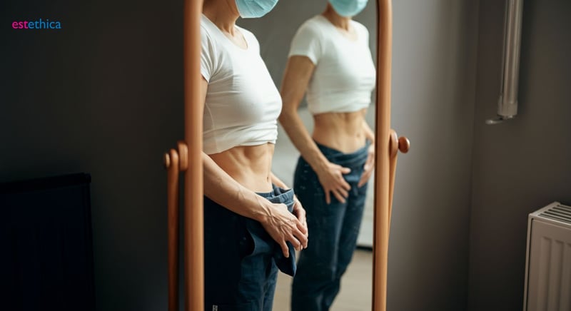 Abdominoplastie corrige diastasis recti et excès de peau