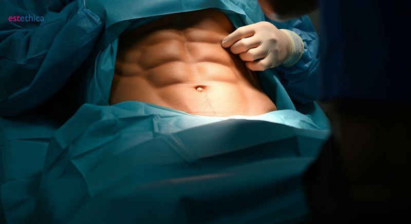 Chirurgie esthétique pour abdominaux sculptés
