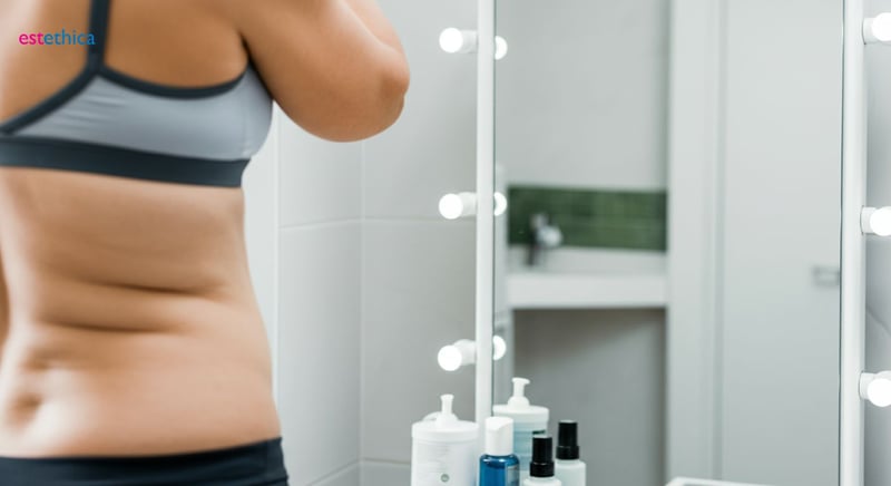 Liposuccion pour améliorer silhouette et bien-être