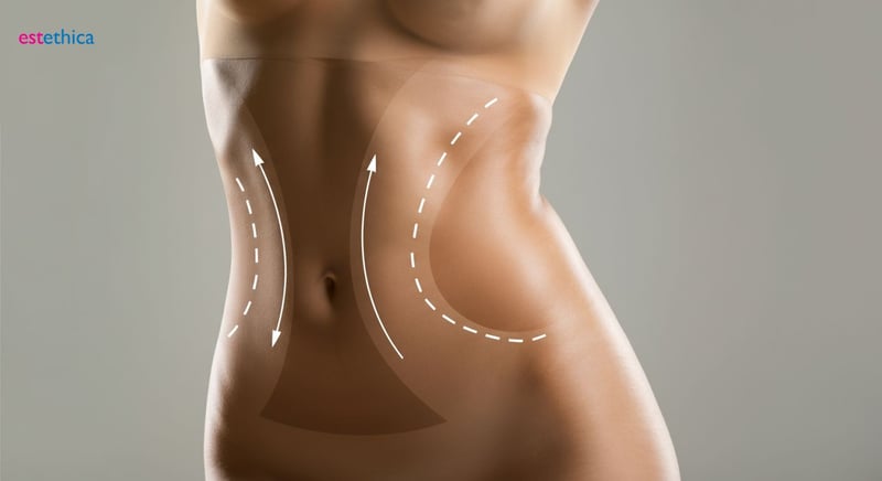 Chirurgie esthétique du ventre étape par étape