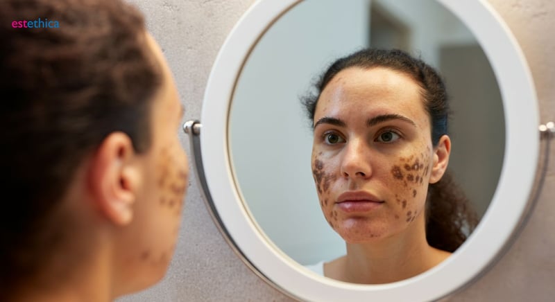 Cremas para manchas según tipo de piel