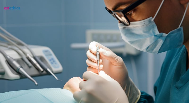 Dental Implants vs. Bridges comparison