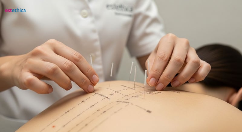 Beneficios de la acupuntura para cuerpo y mente