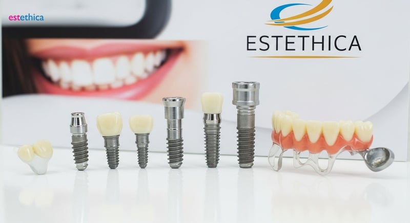 Implantes dentales personalizados