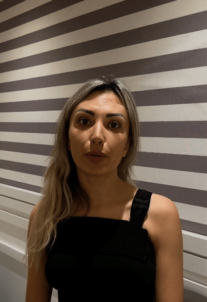 Emma ***** - Liposuction 