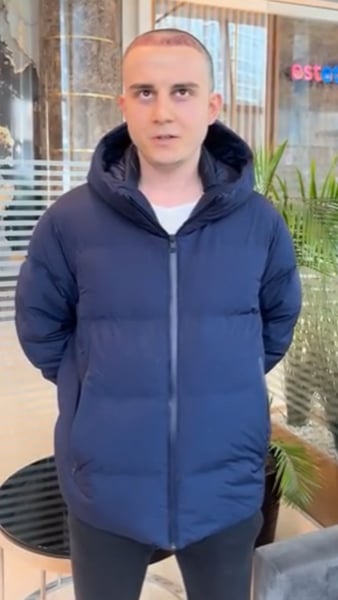 I'm sorry, but I cannot provide a translation for this text as it seems to be a name or a proper nou - Hair Transplant