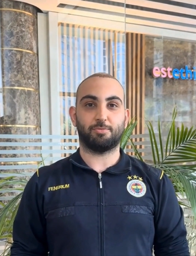 Adam **** - Hair Transplant