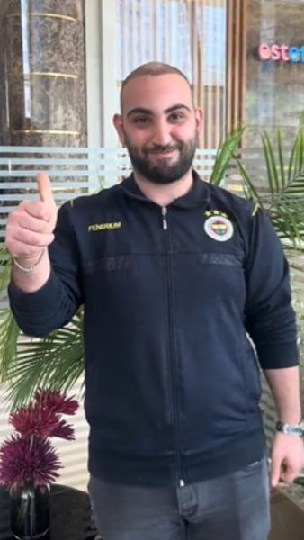 Mehmet A*** - Hair Transplant