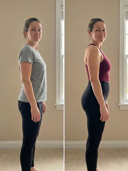 See why patients choose us for the best hair transplant in Istanbul