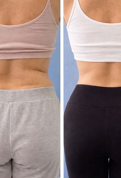 Обмислях липосукция, но се страхувах от операция. Много съм щастлива, че опитах този неинвазивен метод вместо това! Процесът беше комфортен, а резултатите са невероятни. Загубих сантиметри от талията си без нито един ден възстановяване. Наистина е промяна в живота.