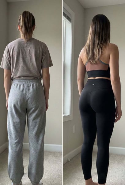 Наистина магически докосване! Никога не съм си представял, че контурите на тялото ми могат да изглеждат толкова балансирани и естетични. Това определено е мястото за най-добрия BBL в Истанбул.