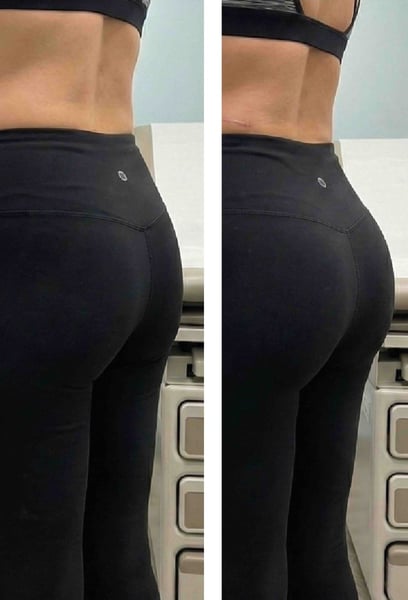 Най-добрата инвестиция, която някога съм правил в себе си! Не само, че тялото ми се промени, но и цялото ми мислене. Всеки, който търси трансформация, може да се довери на тази клиника без колебание.