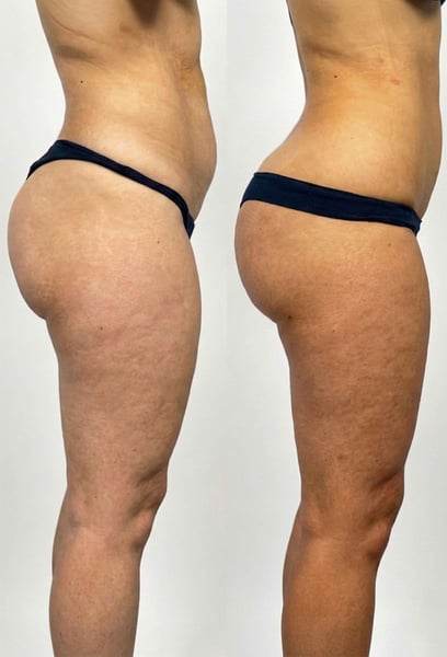 Влюбвам се в себе си всеки път, когато погледна в огледалото! Постигането на тази фигура с пясъчен часовник напълно промени самочувствието ми. Само пожелавам да бях направила това по-рано!