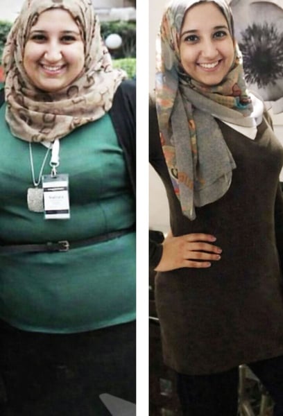 Before the surgery, I was struggling with high blood pressure and joint pain. Now, those issues are gone. The doctors and the nutrition team supported me every step of the way. Truly life-changing!