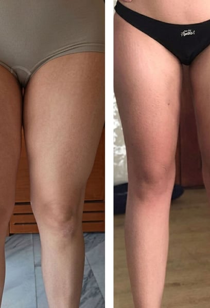 I feel incredibly confident and happy every time I look in the mirror. My thighs are finally toned and gap-free, and I can't wait to wear shorts this summer. The contouring is perfect.