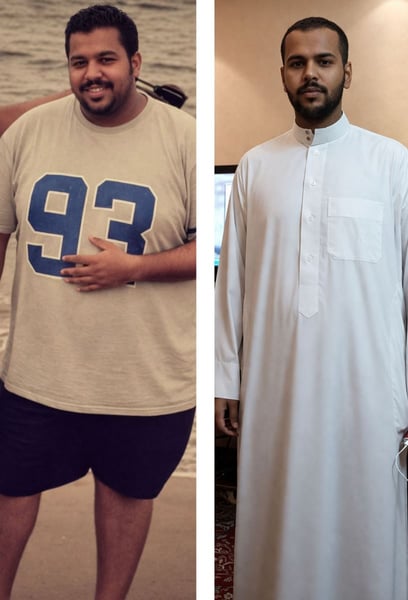 The medical team's expertise made me feel so safe. The surgery was smooth, and the recovery was much faster than I expected. If you are considering bariatric surgery, this is the right place.