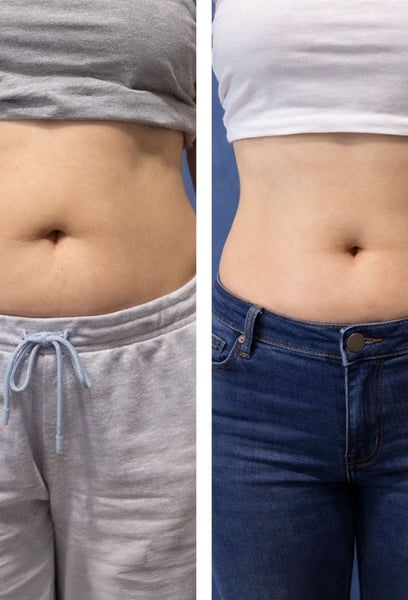 Като човек с много натоварен график, нямам часове за сложни програми за отслабване. Прекарването на само един час седмично в клиниката за моите сесии беше толкова лесно. Ефективно, хигиенично и изключително успешно!