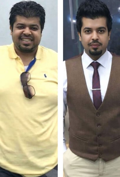 Getting a sleeve gastrectomy at this clinic was the best decision of my life. I’ve lost 40kg in a year, but more importantly, I’ve gained my life back. I feel lighter, healthier, and more energetic than ever!