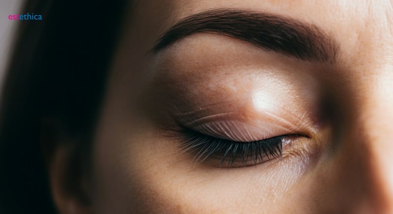 Droopy eyelid correction options: surgical & non-surgical solutions