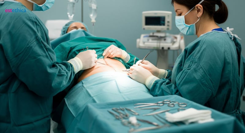 خطوات أساسية للاستعداد لعملية شد البطن