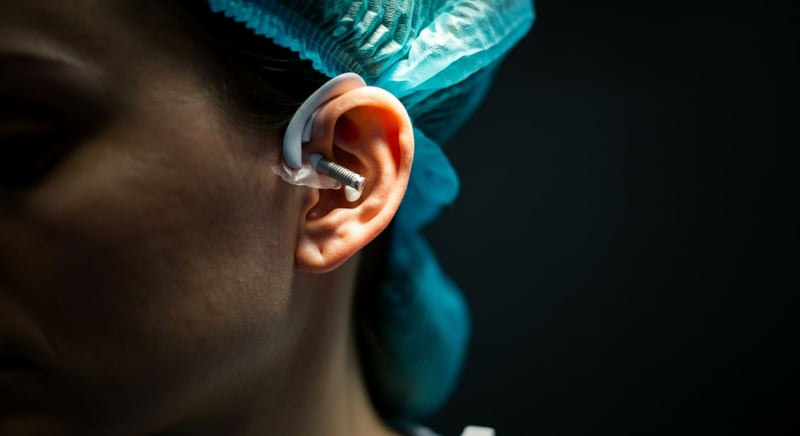 Ear reshaping techniques guide